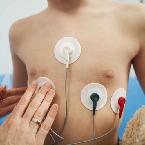 Examen Holter de Ritmo/Arritmia