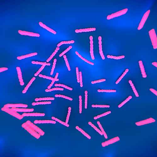 Panel de virus respiratorios + Streptococcus pyogenes