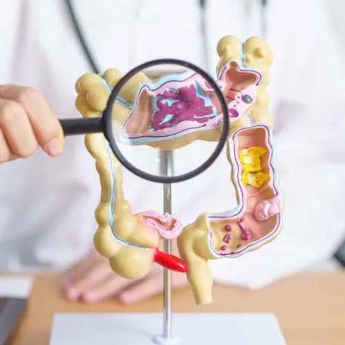 Orden médica online para Examen preventivo para el cancer de colon en Quieromiorden.cl. Accede rápido a tu prescripción. Cuida tu salud con nosotros.