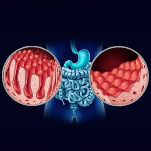 Orden médica online para examen de laboratorio para enfermedad celiaca en Quieromiorden.cl. Accede rápido a tu prescripción. Cuida tu salud con nosotros.