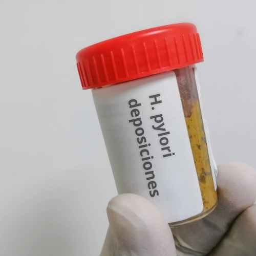 Comprar orden online Quiero mi orden - quiero mi examen - orden medica online - doctor911 - Examen Helicobacter Pylori En Deposiciones
